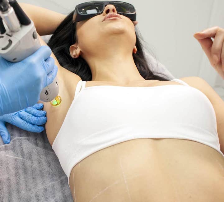 Laser Hair Removal Membership
