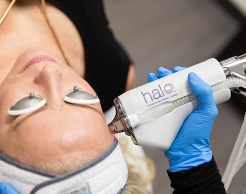 Halo Laser Austin
