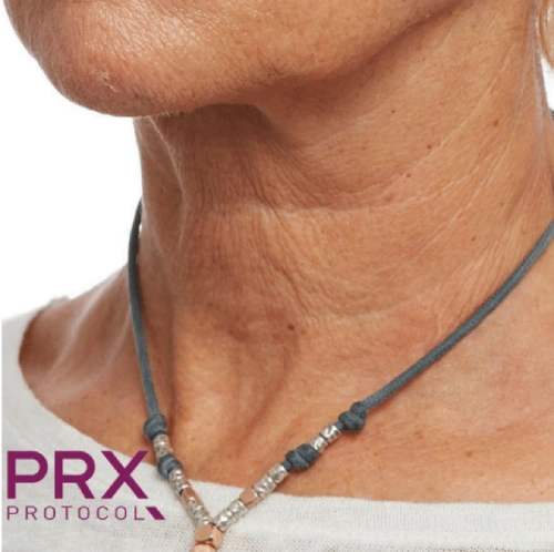 PRX Protocol After 3